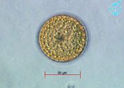 Thalassiosira punctigera.jpg