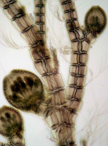 File:Neosiphonia harvei2.jpg